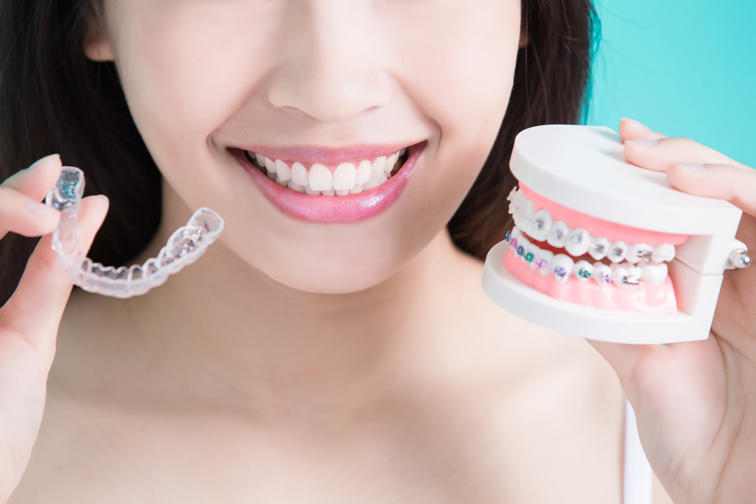 invisalign cost Auckland