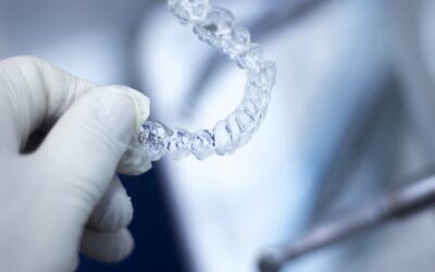 Can You Have an Allergic Reaction to Invisalign?