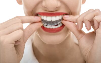 Why Invisalign is Trending in 2021!