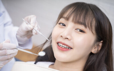 What are the Different Types of Orthodontic Appliances?